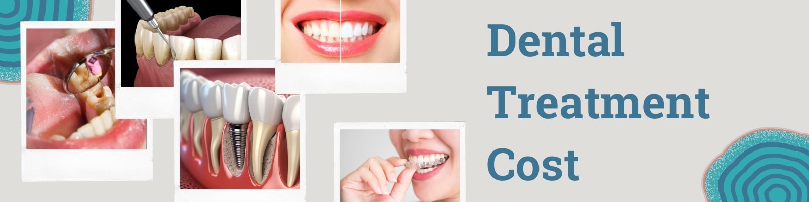 Dental Treatment Charges