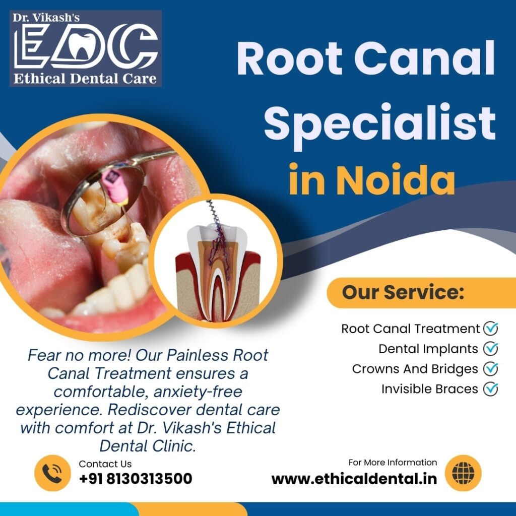 Meet The Best Root Canal Specialist in Noida and Delhi NCR