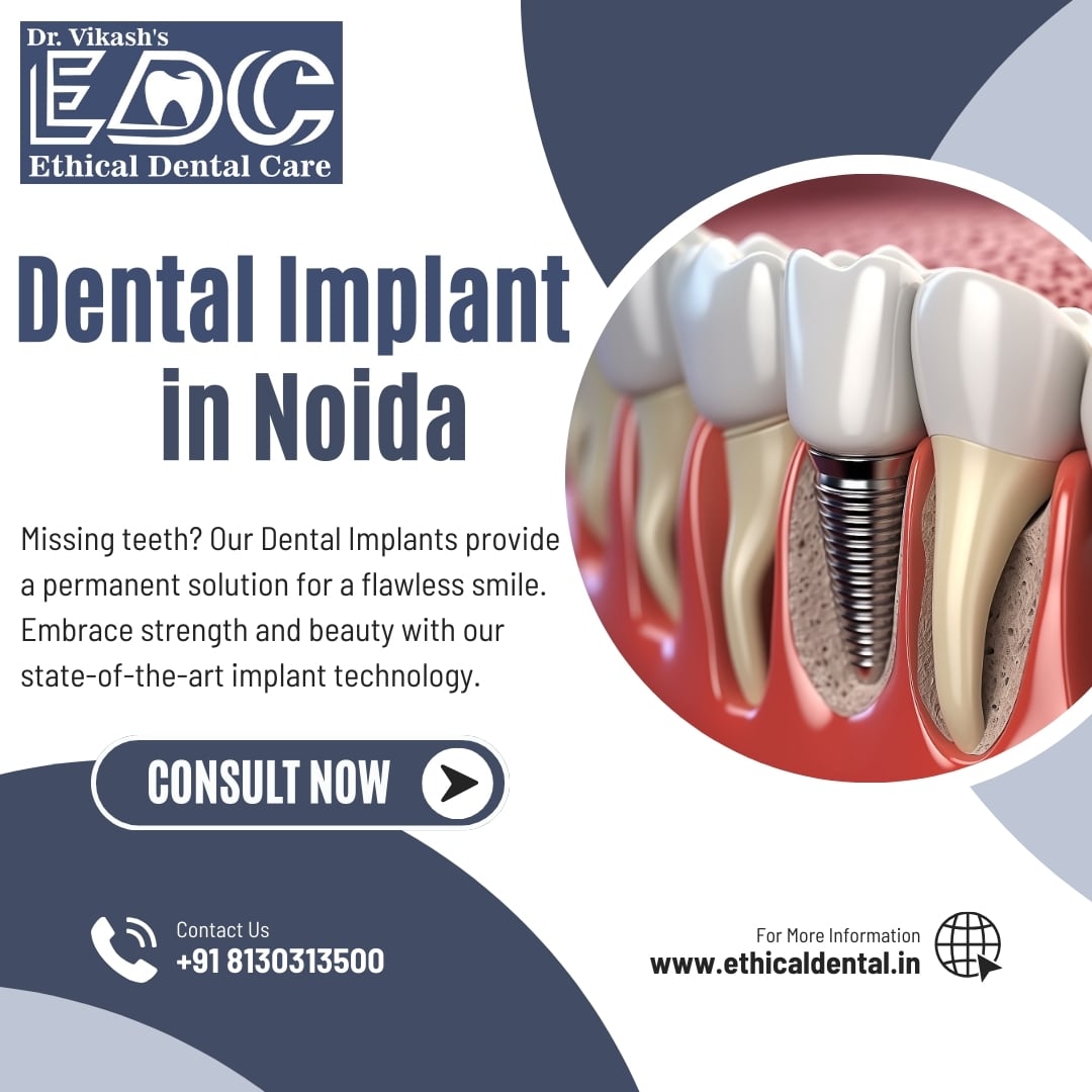 Top Dental Implants Dentist in Noida | Dr. Vikash Kumar