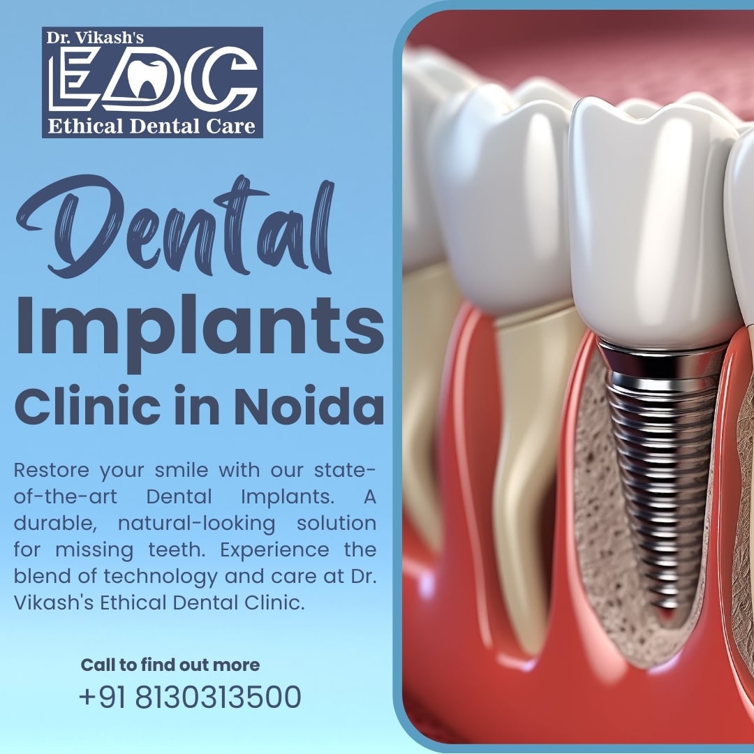 Best Dental Implant Clinic in Noida – Dr. Vikash’s Ethical Dental Care