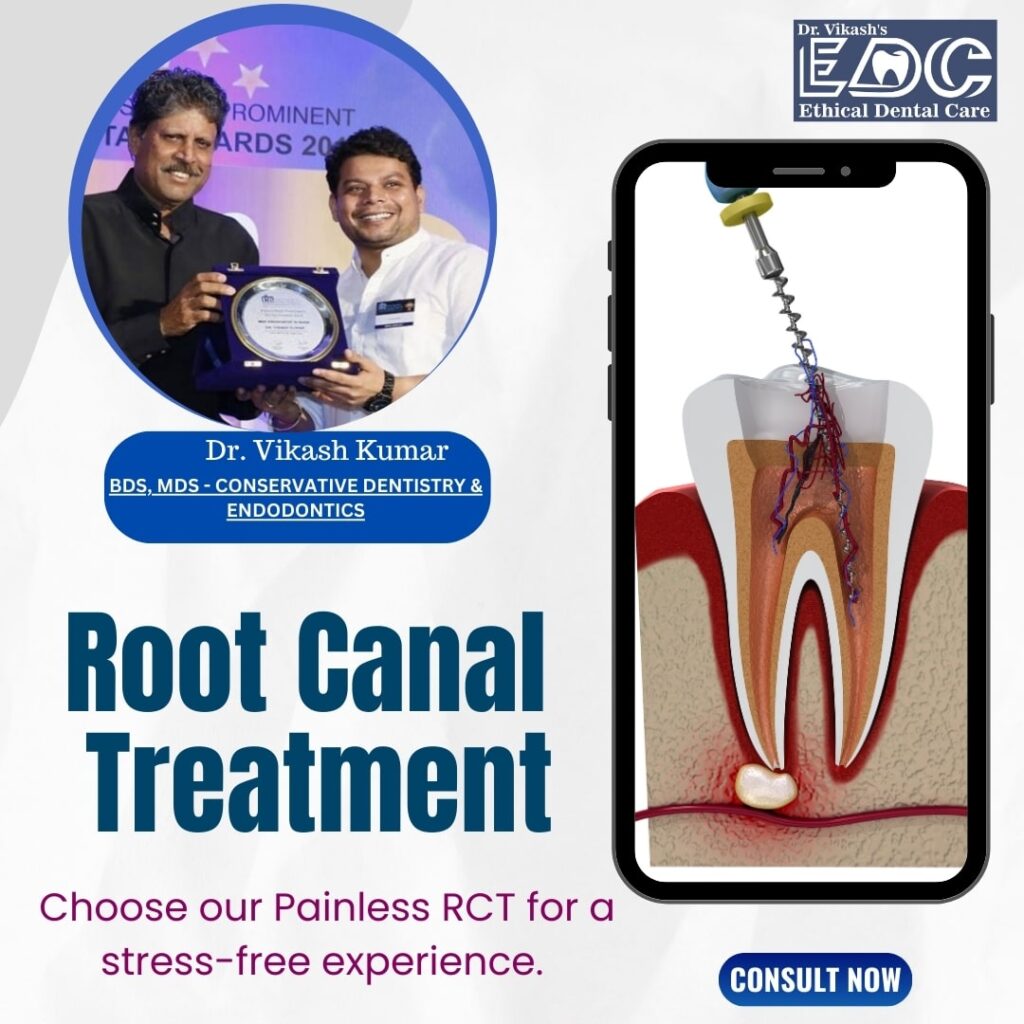 Root Canal Treatment – Procedure, Importance, and Options by Dr. Vikash Kumar