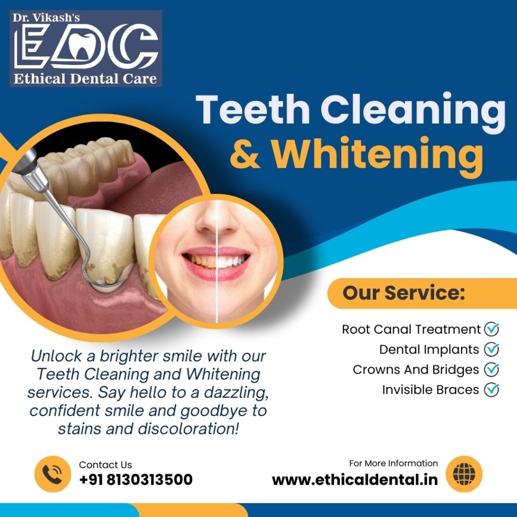 Professional Teeth Cleaning & Whitening by Best Dentist in Noida