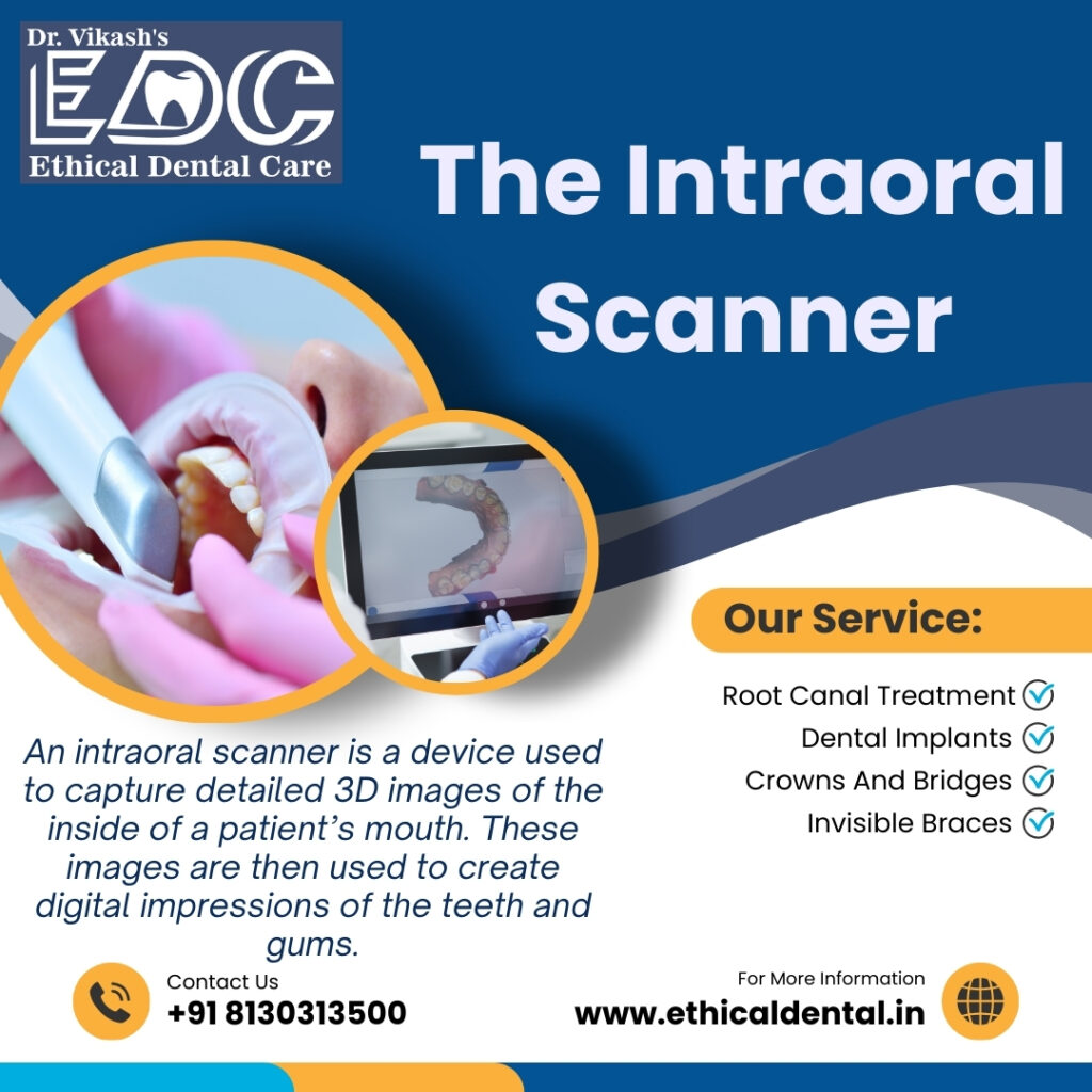 The Intraoral Scanner – Revolutionizing Dental Care in India