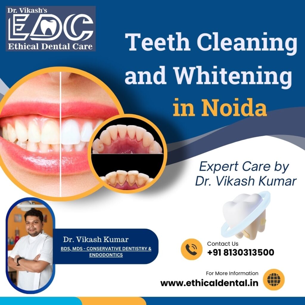 Teeth Cleaning and Whitening – Expert Care by Dr. Vikash Kumar