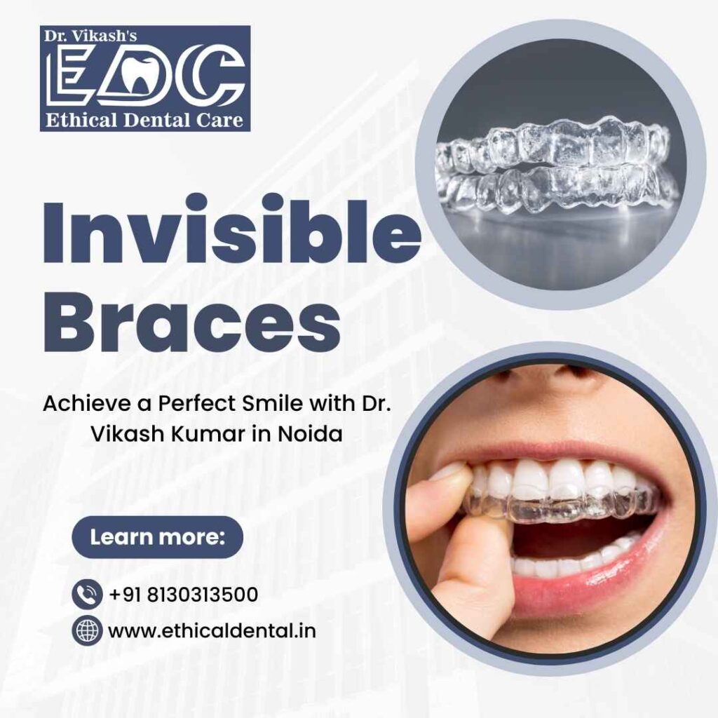 Invisible Braces – Achieve A Perfect Smile with Dr. Vikash Kumar