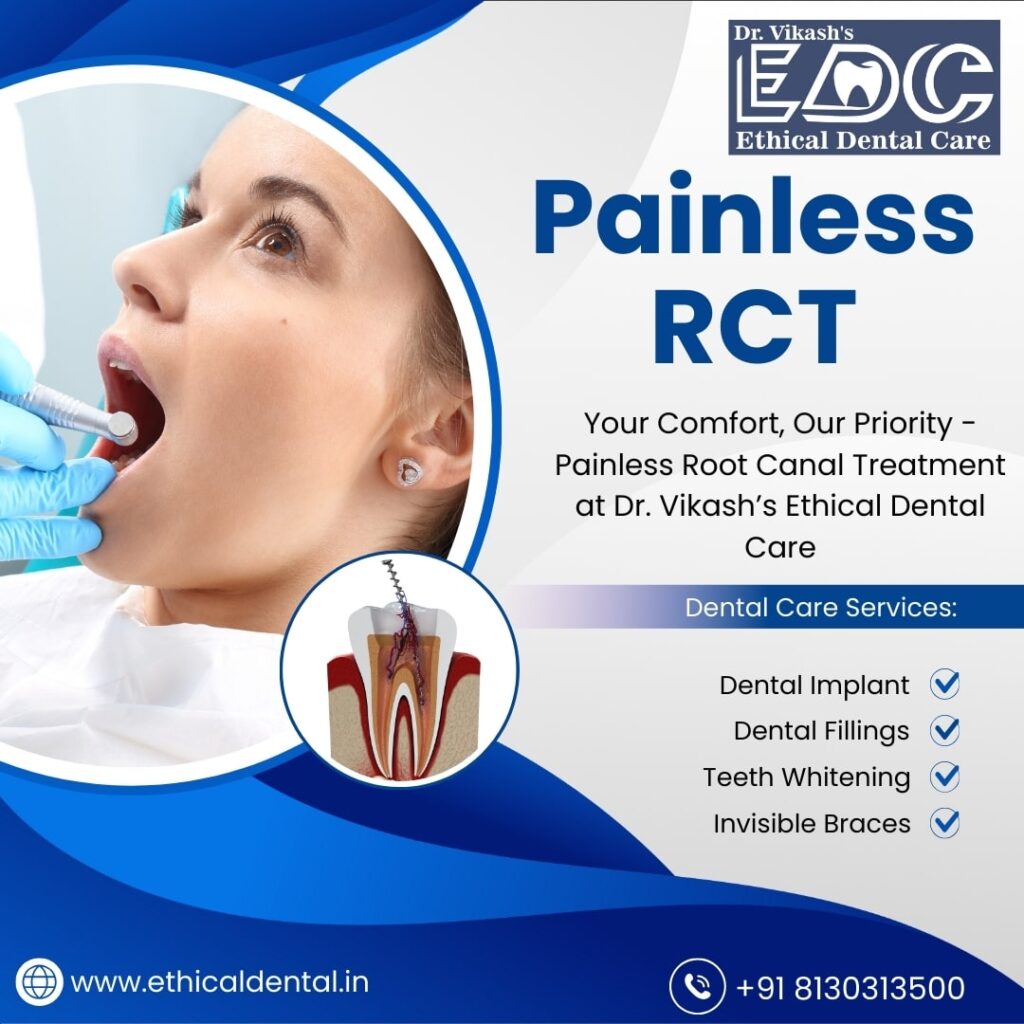 Painless Root Canal Treatment in Noida – Dr. Vikash’s Ethical Dental Care