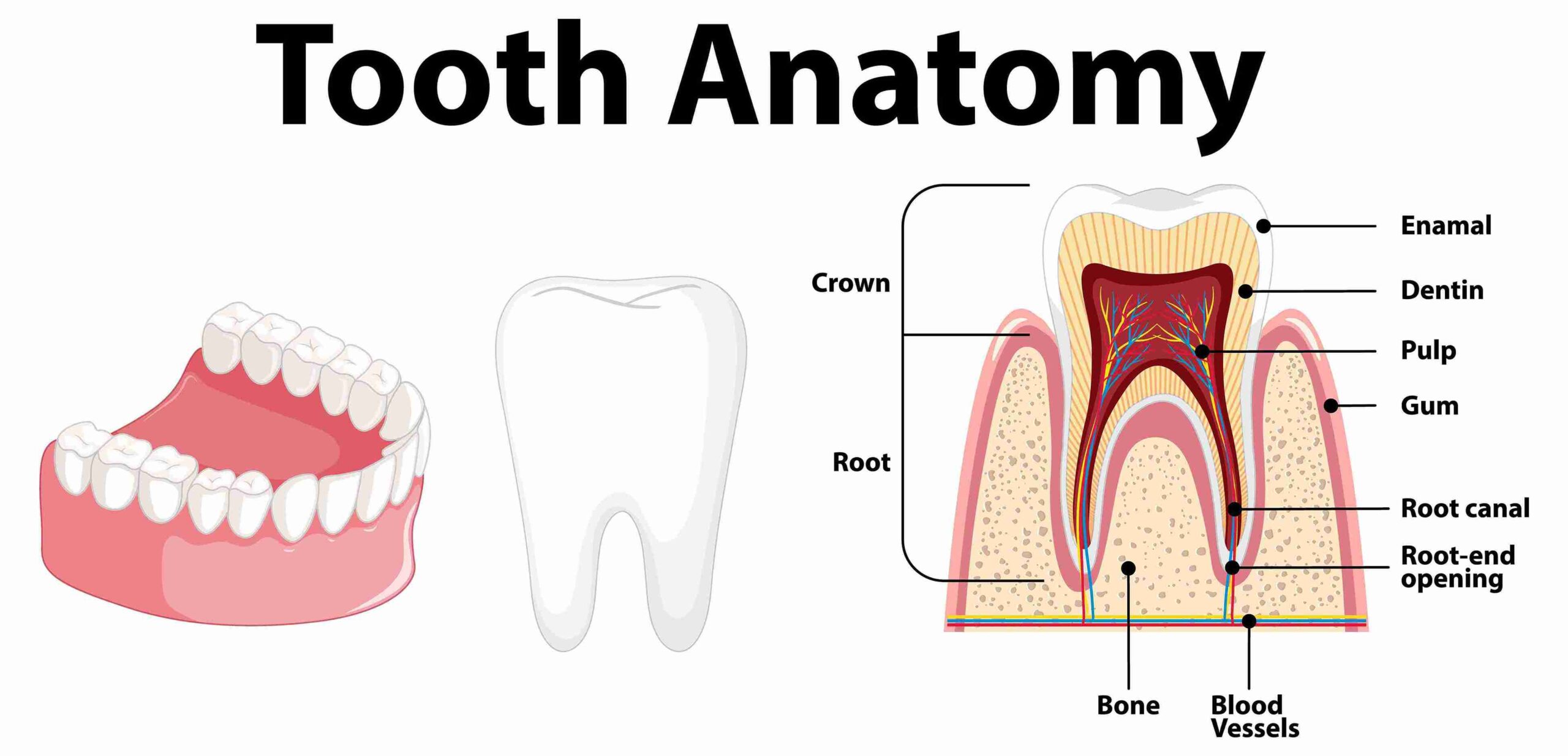 Root Canal treatment