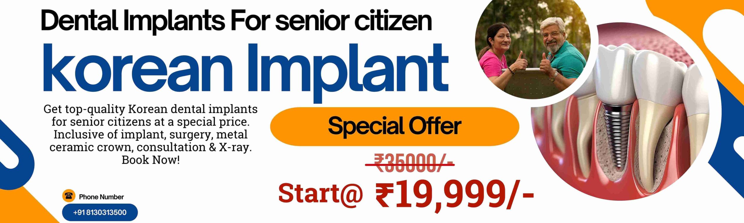 Dental implant For Senior Citizens