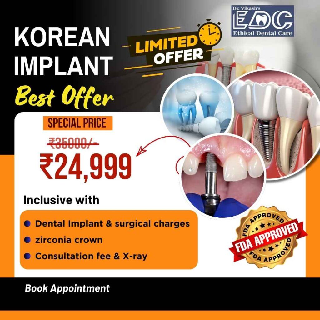 Dental Implant offers