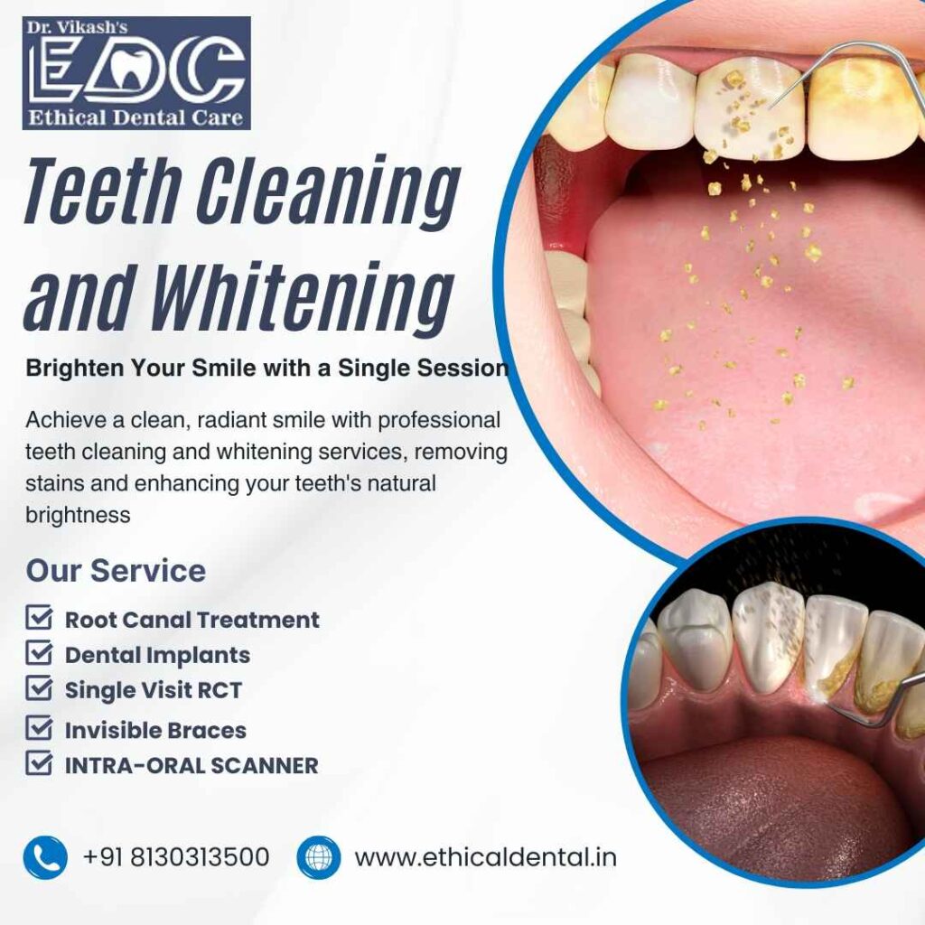 Teeth Cleaning and Whitening in Noida | The Path to a Healthy Smile