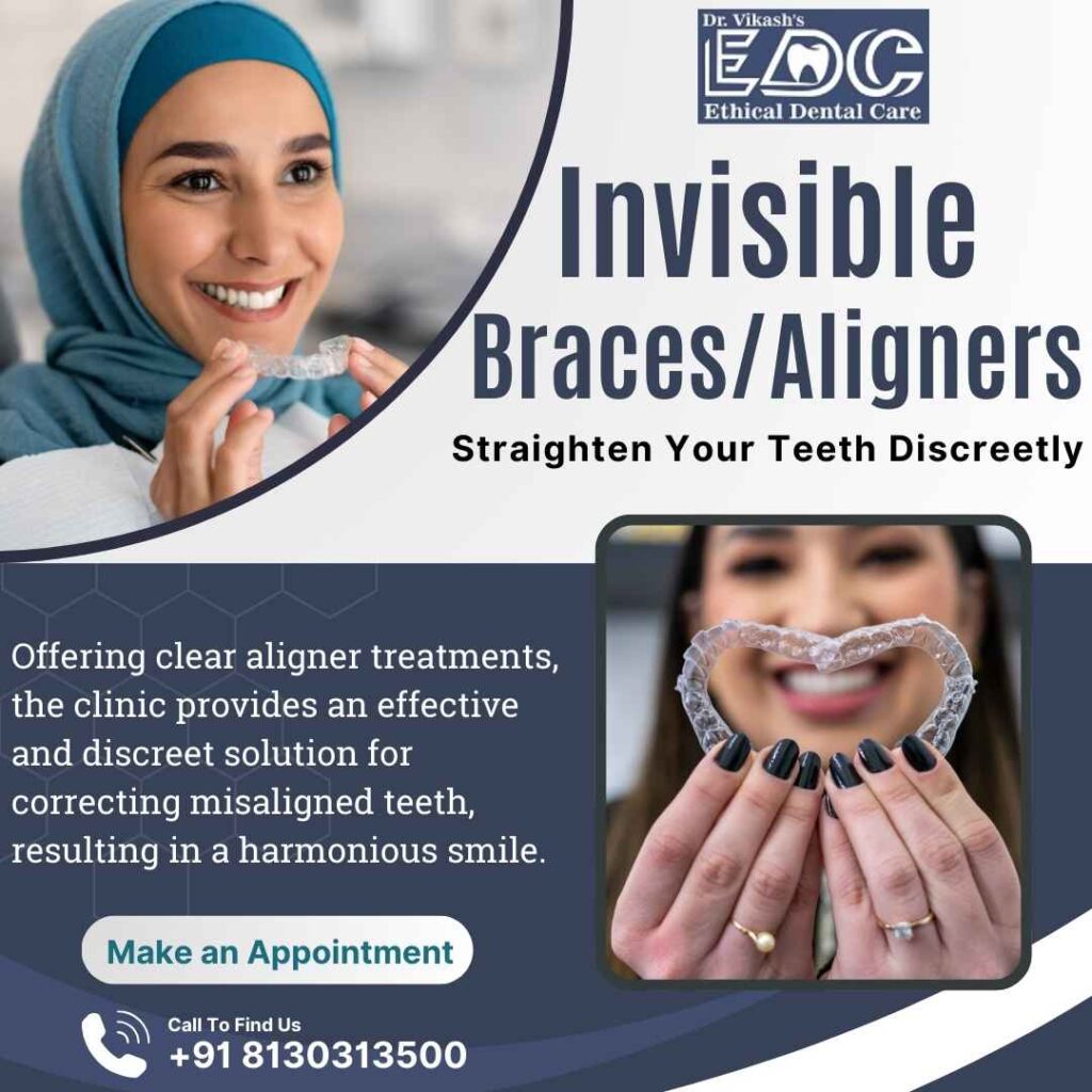 Invisible Braces/Aligners in Noida | A Modern Solution for a Perfect Smile