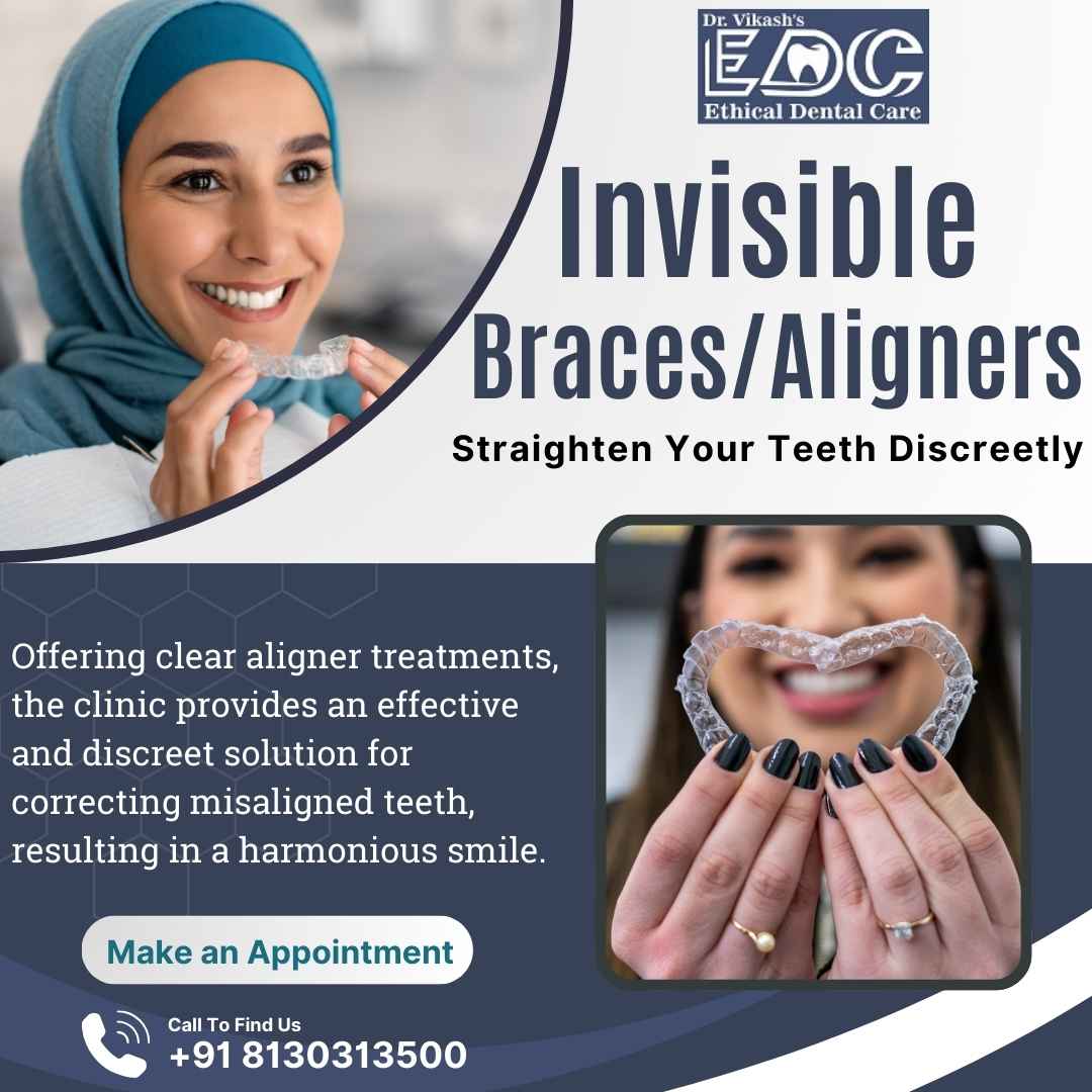 Invisible Braces/Aligners in Noida | A Modern Solution for a Perfect Smile